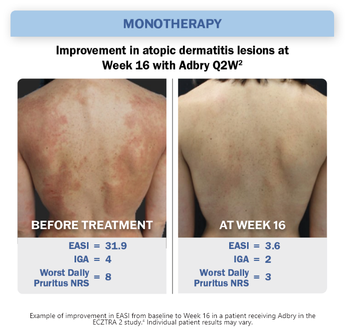 Monotherapy Image
